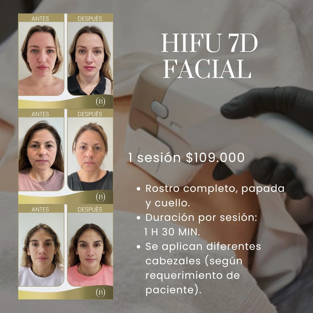 HIFU FACIAL